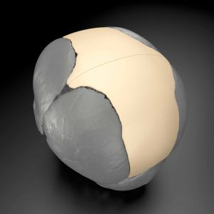 MedCAD - Custom Surgical Solutions