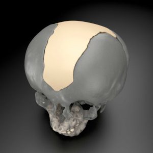 MedCAD - Custom Surgical Solutions