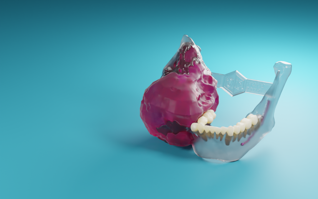 MedCAD - Custom Surgical Solutions